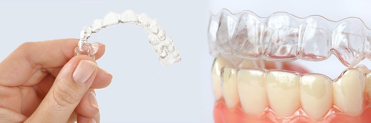 Peabody Alternative to Braces for Teens