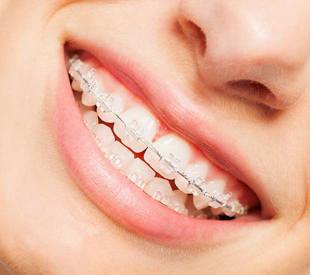 Peabody Invisible Orthodontics