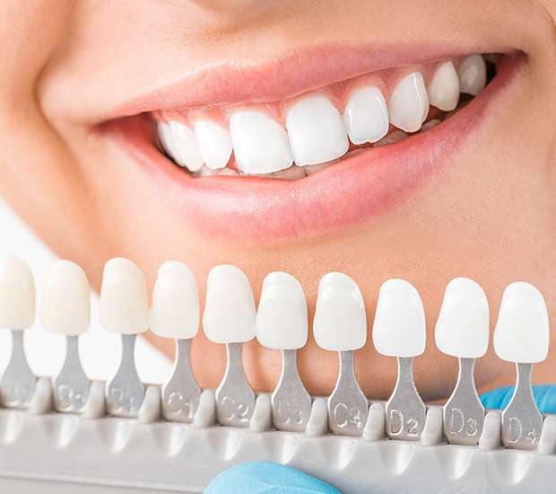 Peabody Cosmetic Dentist