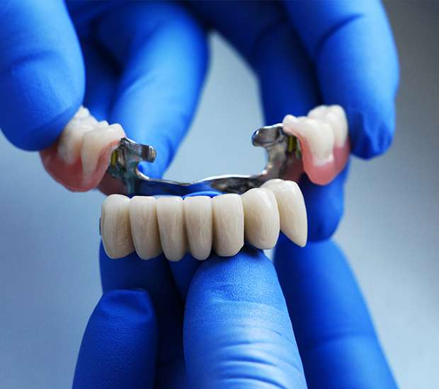 Peabody Dental Bridges