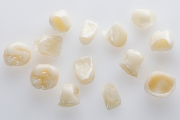 Alternatives To Dental Crowns