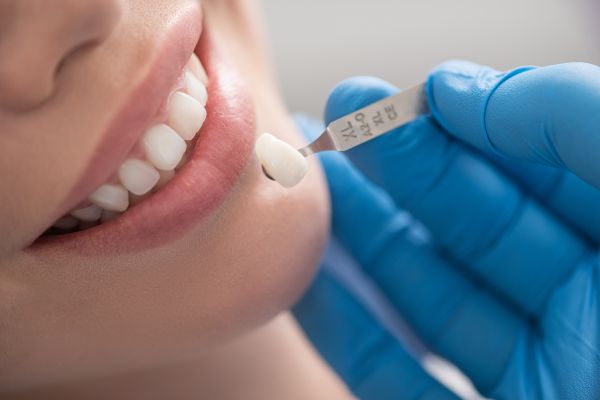 How Dental Crowns Repair and Renew Damaged Teeth