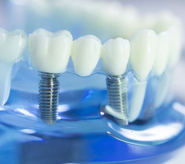 Peabody Dental Prosthetics