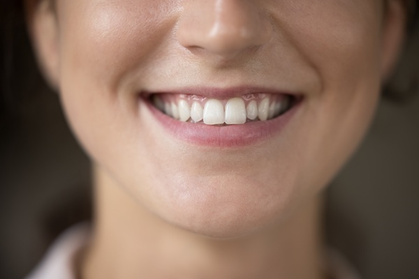 Will Dental Restorations Ever Fail?