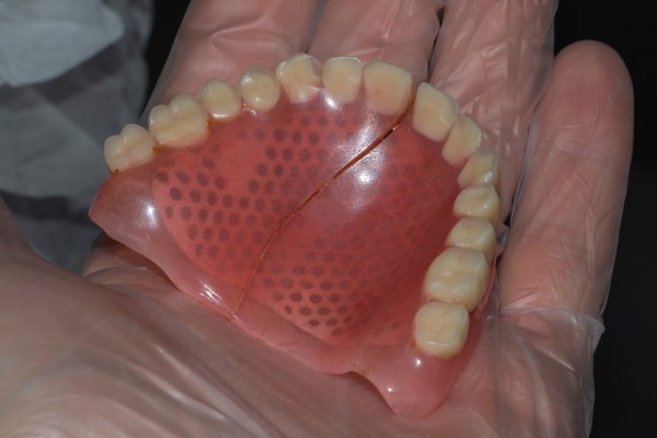 Reasons A Dentist Is Needed For Denture Repair