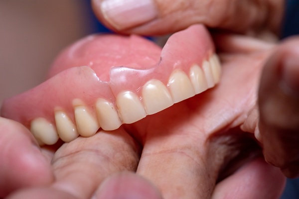 Signs It Is Time For Professional Denture Repair