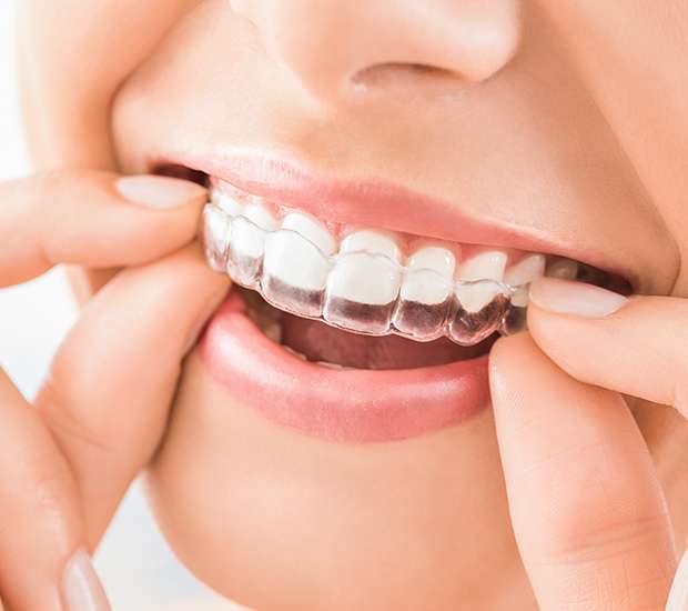 Peabody Does Invisalign® Really Work?