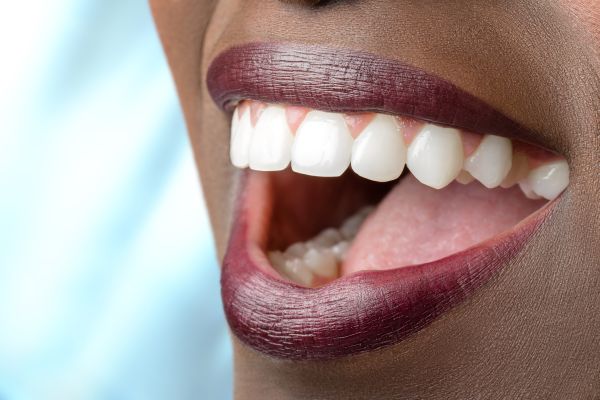 Fixing Broken Teeth Through A Full Mouth Reconstruction