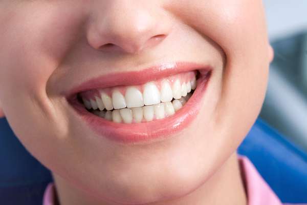 A General Dentist Discusses the Benefits of Tooth Straightening from Northside Dental Care, PC in Peabody, MA