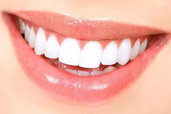 How Long Does Teeth Whitening Take from Northside Dental Care, PC in Peabody, MA
