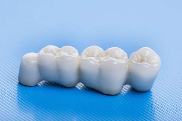 How Many Teeth Can Dental Bridges Replace from Northside Dental Care, PC in Peabody, MA