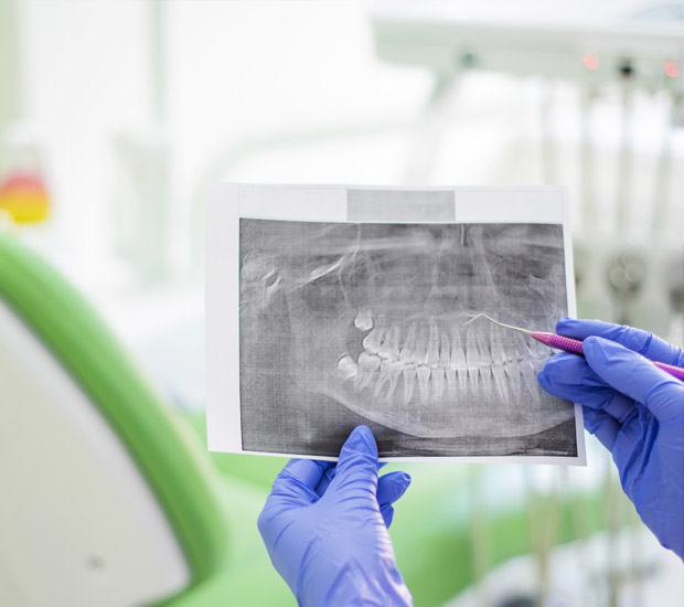 Peabody Interactive Periodontal Probing