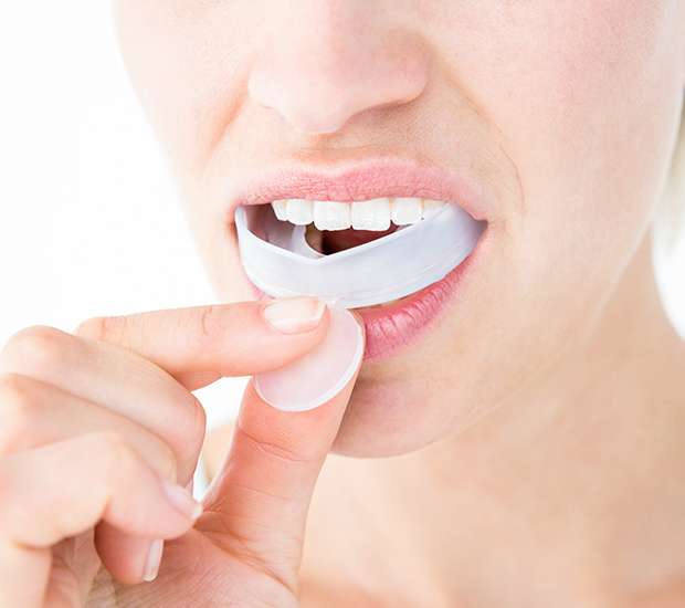 Peabody Mouth Guards