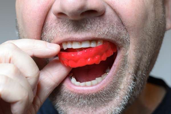 Save Your Teeth by Wearing Mouth Guards at Night from Northside Dental Care, PC in Peabody, MA
