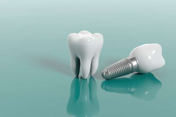 Multiple Teeth Replacement Options: One Implant for Two Teeth from Northside Dental Care, PC in Peabody, MA
