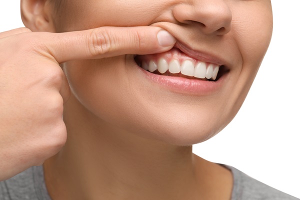 Choosing In Chair Or Take Home Teeth Whitening