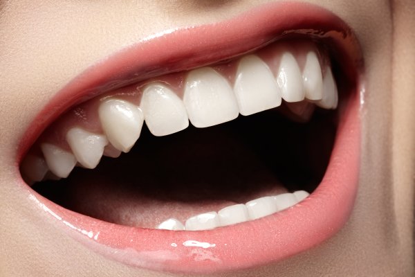 Learn About Professional Teeth Whitening Brands