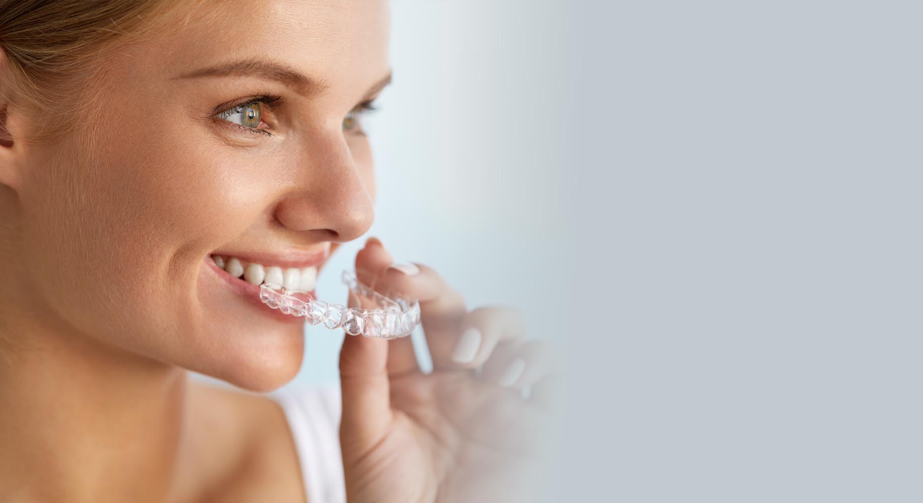 Invisalign Braces